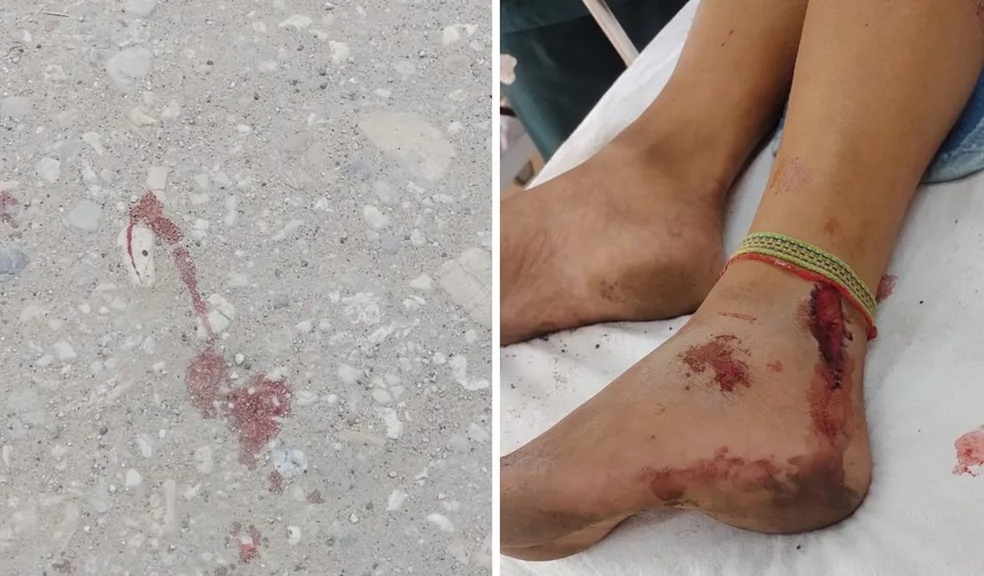 Grávida de cinco meses é vítima de estupro no interior de SP