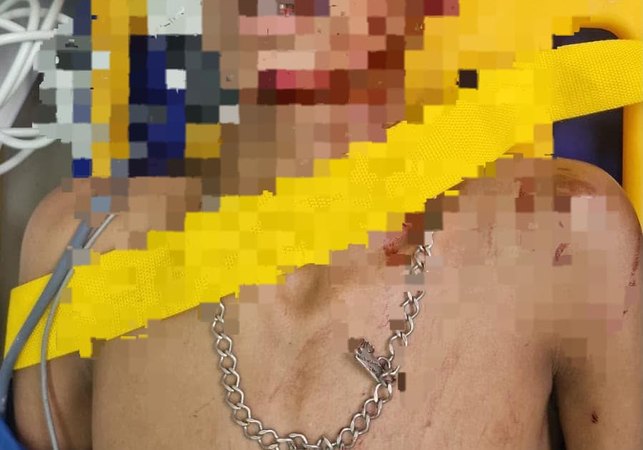 Adolescente de 16 anos é apreendido suspeito de esfaquear jovem no bairro Manoel Teles, em Arapiraca
