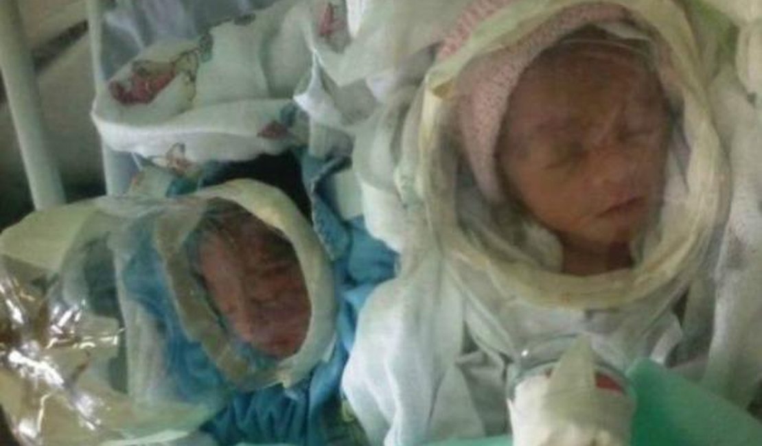 Sem suporte neonatal, hospital usa garrafas pet como máscaras e uma recém-nascida morre