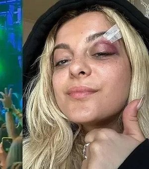 Cantora Bebe Rexha é atingida por celular durante show