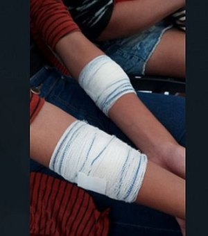 Adolescente de 15 anos fica ferida após ser golpeada com estilete dentro ônibus escolar, em Arapiraca