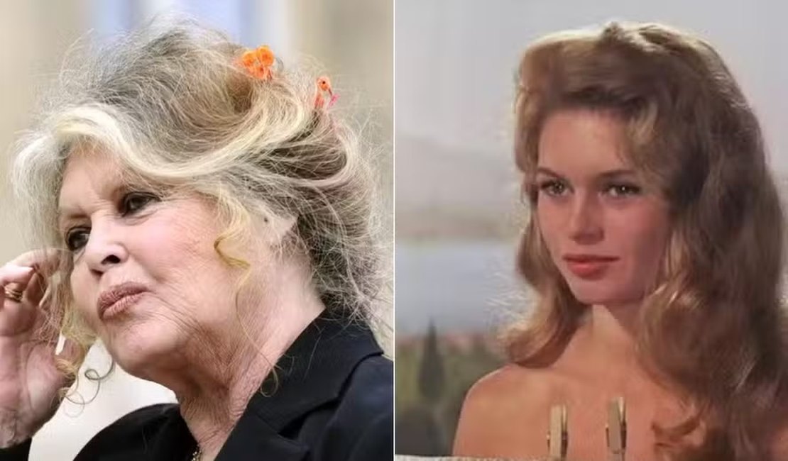 Brigitte Bardot, de 91 anos, é internada em estado grave e passa por cirurgia na França