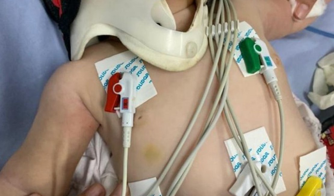 Pai de bebê internada com mais de 30 lesões é preso; criança já respira sem ajuda de aparelhos