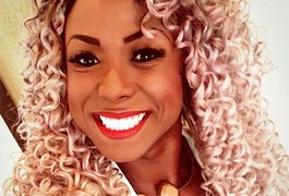 Ex-BBB Adélia passa por intervenção cirúrgica para retirada das bochechas