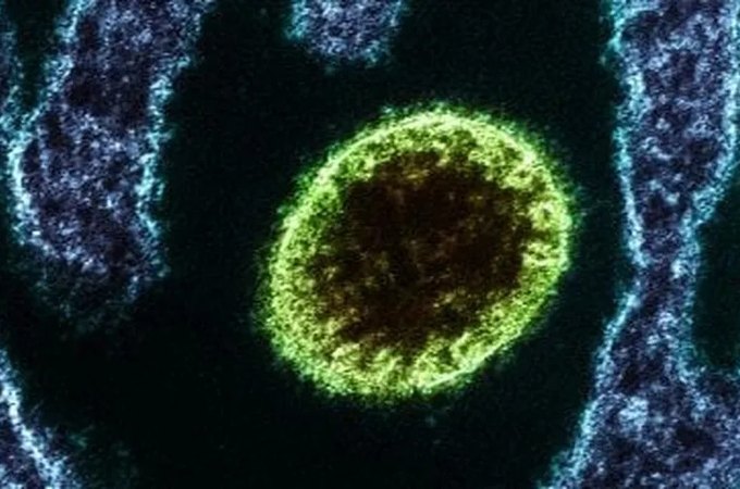 Surto de vírus letal Nipah deixa Índia em alerta; conheça os riscos do microrganismo