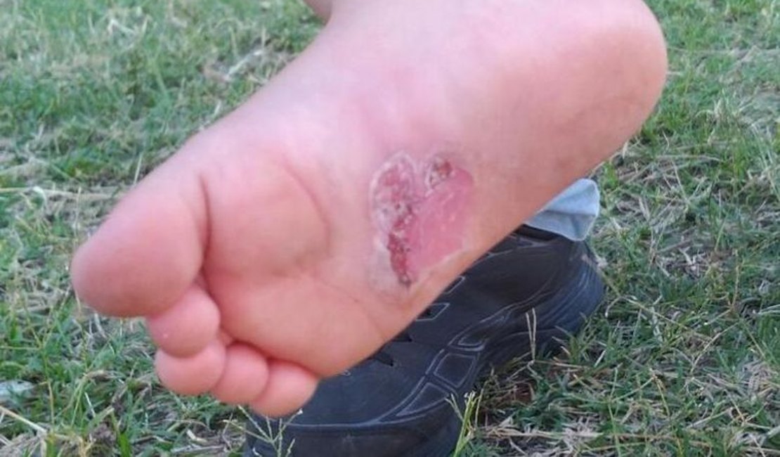 Polícia conclui inquérito e prende casal suspeito de torturar crianças