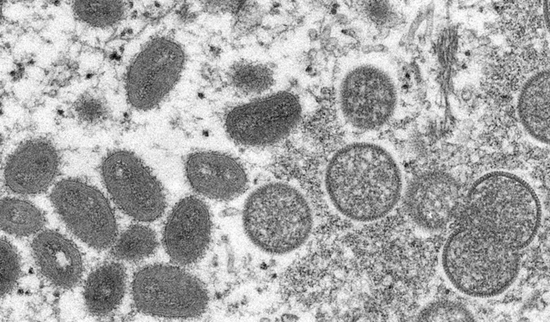 Quatro casos suspeitos da varíola dos macacos são descartados em AL e 10 estão em investigação