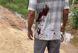 Homem é esfaqueado nas costas após discussão, na zona rural de Palmeira dos Índios