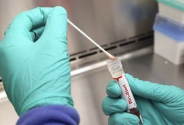 Casos de mpox mais que dobram em 20 dias, com 129 confirmações no Brasil