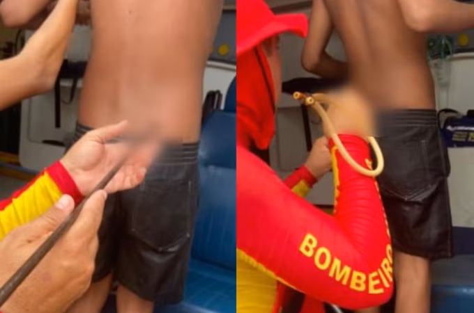 Adolescente é atingido por arpão durante pesca na Praia do Francês, em Marechal Deodoro