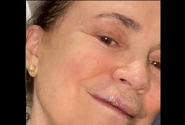 Regina Duarte quebra três dentes enquanto digitava mensagem no celular