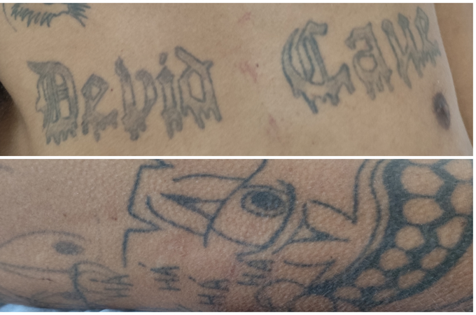 Hospital de Emergência do Agreste procura familiares de paciente identificado apenas como Rafael