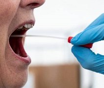 Com 90% de eficácia, SWAB será disponibilizado em Arapiraca para testagem de Covid-19