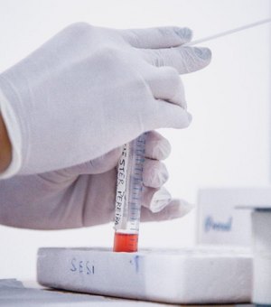 Central de Triagem de Arapiraca inicia testes RT-PCR nesta terça-feira (16)