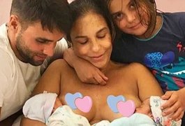 Ivete publica foto amamentando gêmeas e post ganha mais de 2 milhões de curtidas