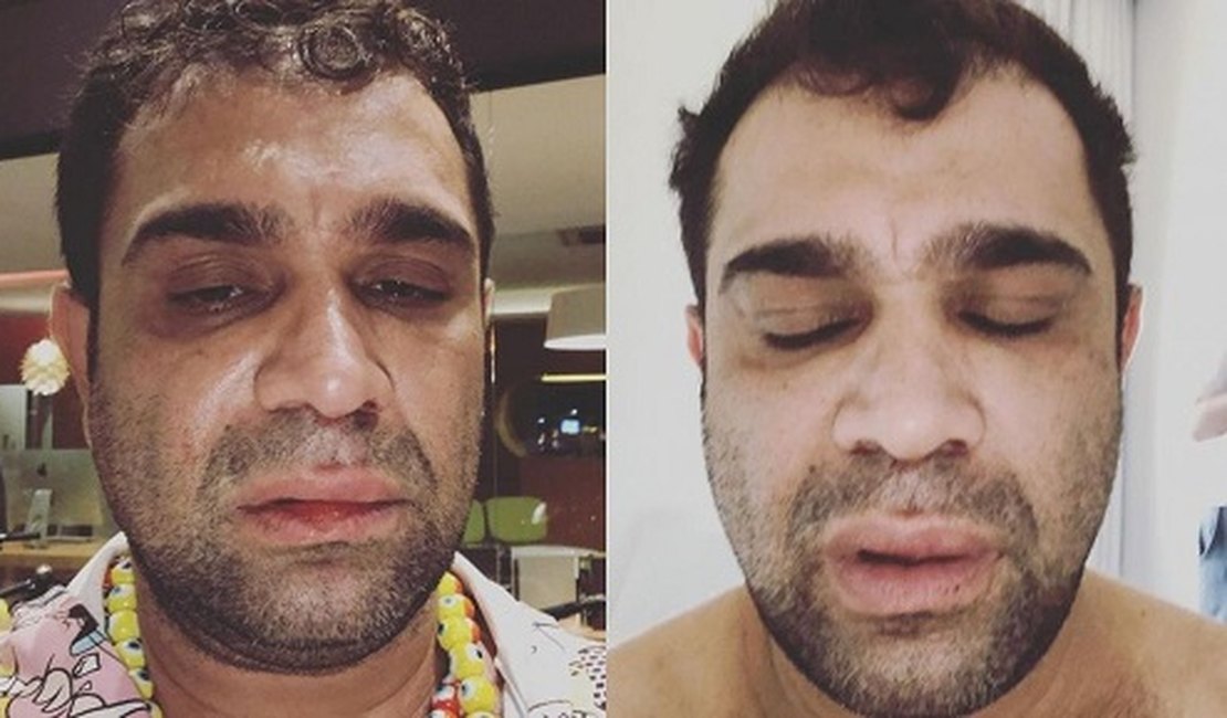 Ex-Pânico relata agressão após show: 'Homofobia e covardia'