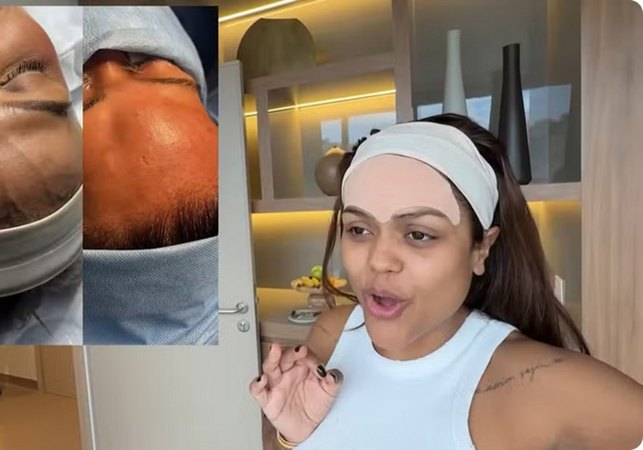 Influenciadora Camila Loures retira 'veia saltada' na testa; procedimento carece de respaldo científico