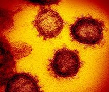 Estudo aponta sequelas neurológicas em pacientes leves de covid-19