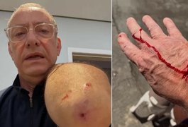 Jornalista da Globo é atacado por pitbull sem guia