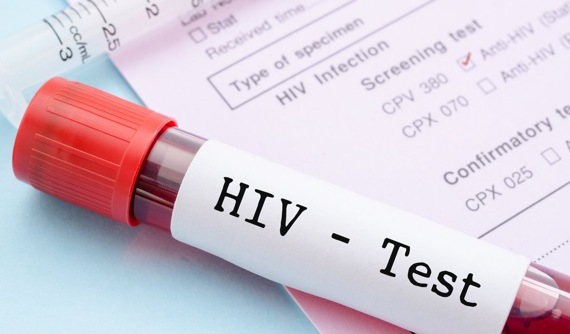 Teste de vacina contra HIV tem bons resultados