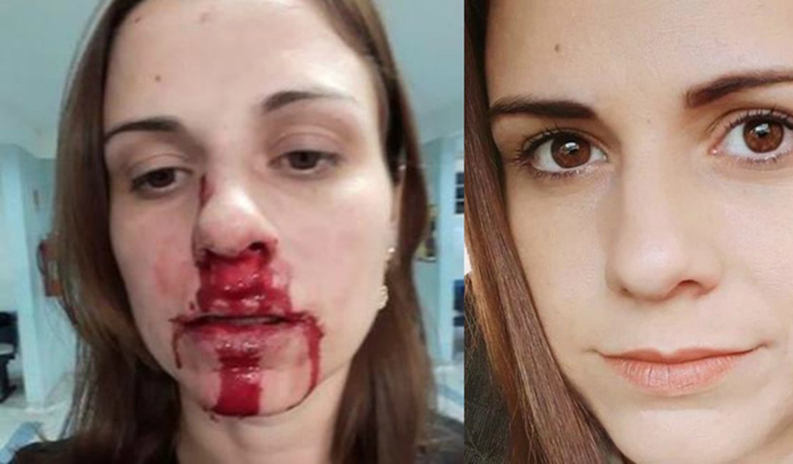 Mulher acusa ex-marido de agressão e posta foto com rosto ensanguentado