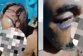 Suspeitos de agredir idoso a pedradas e pauladas são capturados pela PCAL