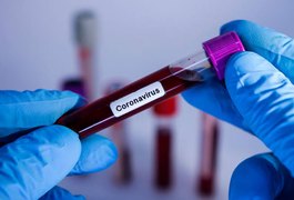 Covid-19: Arapiraca registra 7.735 confirmados e mais 4 óbitos