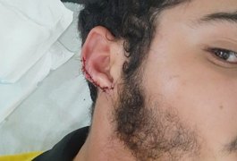 Homem que arrancou parte da orelha de funcionário de lanchonete é denunciado pelo MPE