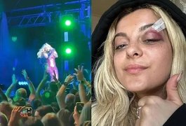 Cantora Bebe Rexha é atingida por celular durante show