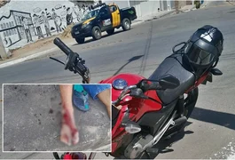 Motociclista com sinais de embriaguez tem o pé mutilado após acidente em São Miguel dos Campos