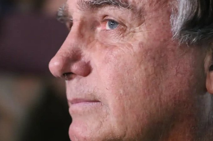 Defesa de Bolsonaro reitera pedido por cirurgia e prisão domiciliar