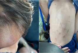 Justiça mantém prisão de pais suspeitos de espancar filho de 4 anos em Maceió