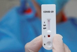 Resolução da ANS obriga planos de saúde a realizar teste sorológico para Covid-19