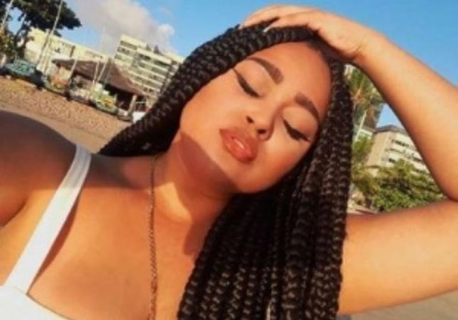 Ex-BBB alagoana sofre acidente com moto elétrica e revela fratura no olho