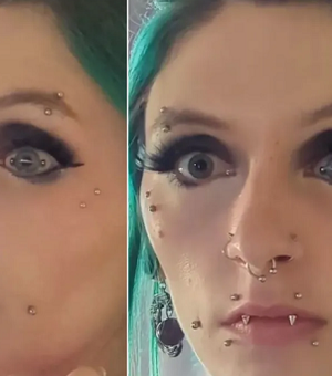 Mulher viraliza com 'piercing' em globo ocular: 'Como você pisca?'