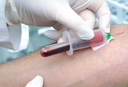 Pesquisadores desenvolvem exame de sangue que pode diagnosticar esquizofrenia