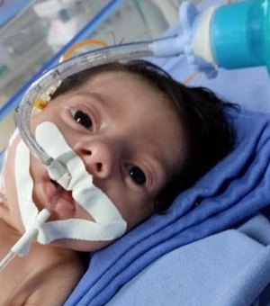 Bebê de apenas 3 meses diagnosticado com fibrose cística é transferido para a Santa Casa, em Maceió