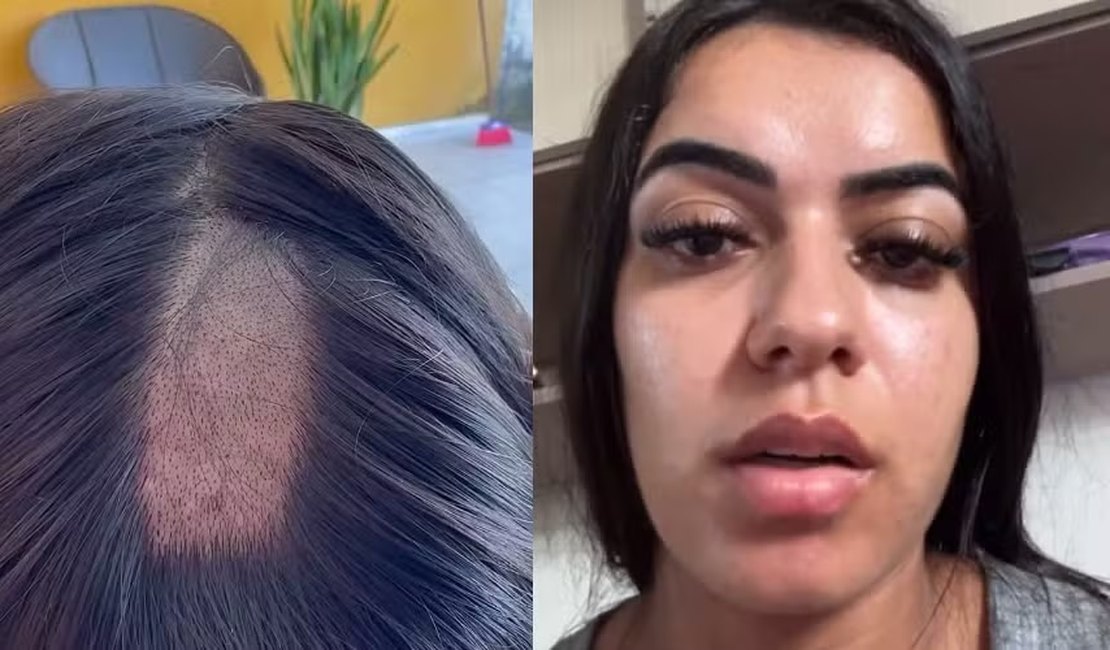 Mulher denuncia clínica após ter cabelo raspado em exame toxicológico para CNH