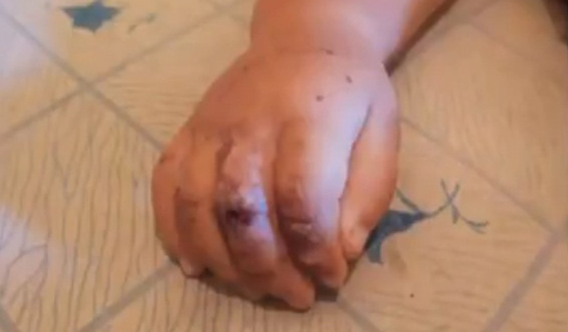 Padrasto confessa assassinato de bebê de oito meses em Maceió