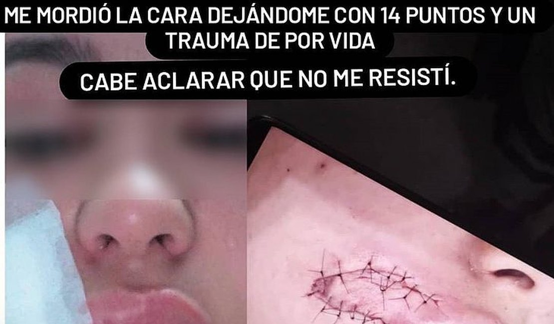 Justiça mantém prisão de suspeito que mordeu turista em tentativa de assalto em Maceió