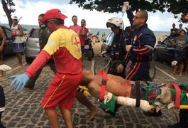 Homem é atacado por tubarão em praia de Recife