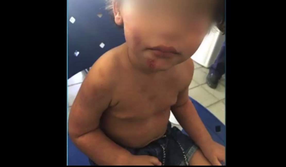 Mãe e padrasto são denunciados por agredir criança em Maceió