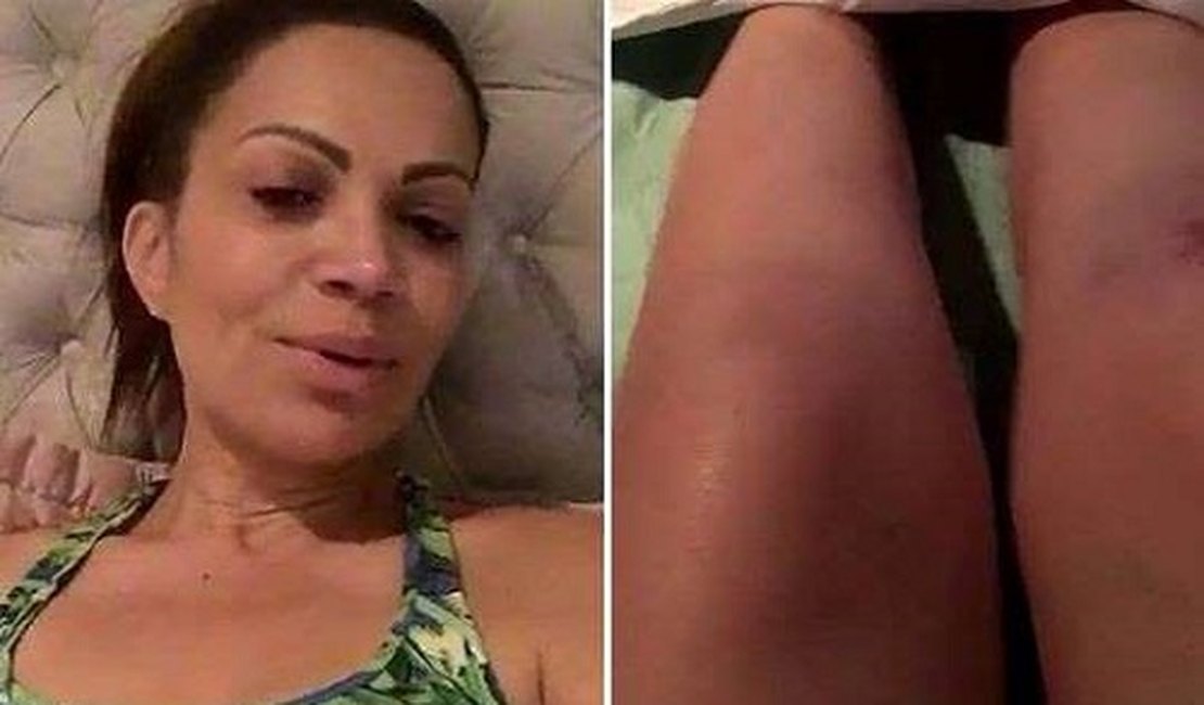 Solange Almeida cai no palco e fica ferida durante show no Rio Grande do Norte