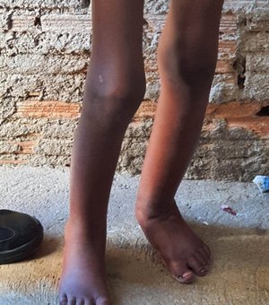 Para ‘educar filho’, pai amarra e acorrenta criança de 11 anos em barril