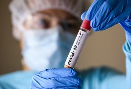Arapiraca registra 115 casos positivos do novo coronavírus e um óbito