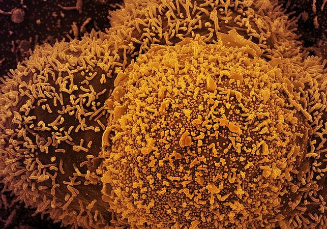 Nova variante da Covid com maior escape imunológico é confirmada em 23 países