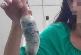 Mulher tenta entrar em presídio de Maceió com drogas escondidas nas partes íntimas