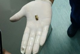 PMs são baleados em troca de tiros com suspeitos de tráfico, em Jacuípe