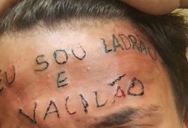 Campanha arrecada quase R$ 20 mil para apagar tatuagem da testa de adolescente