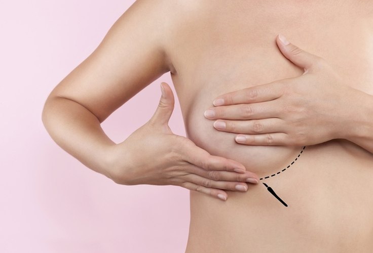 Projeto que garante cirurgia reparadora de mama vai à sanção